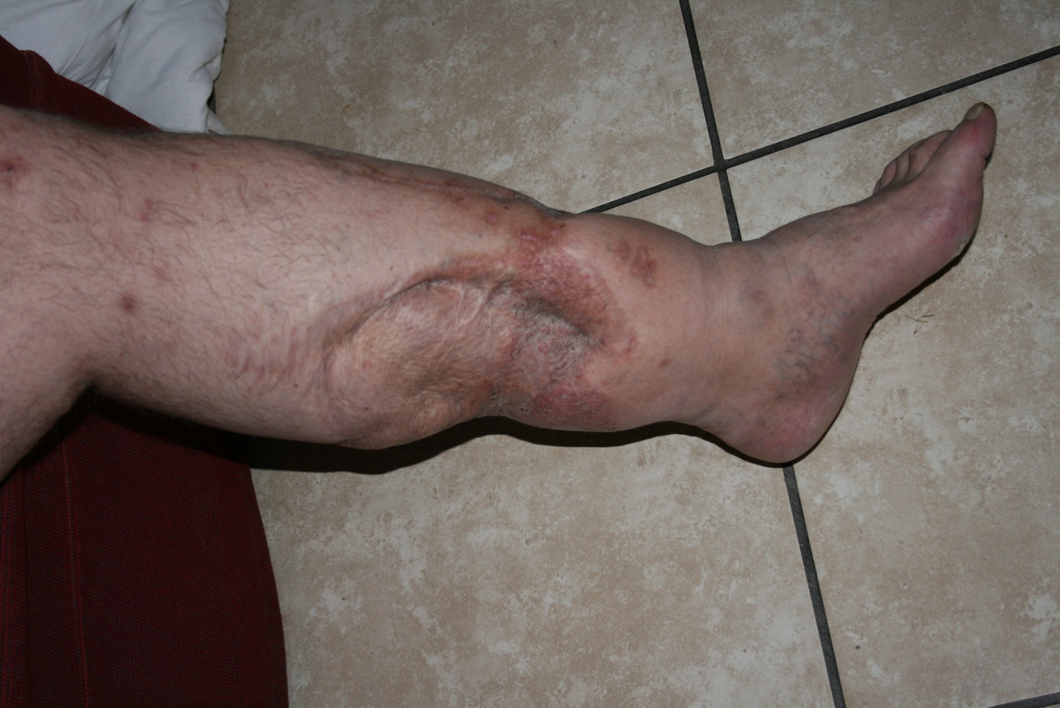A close-up of a leg

AI-generated content may be incorrect.