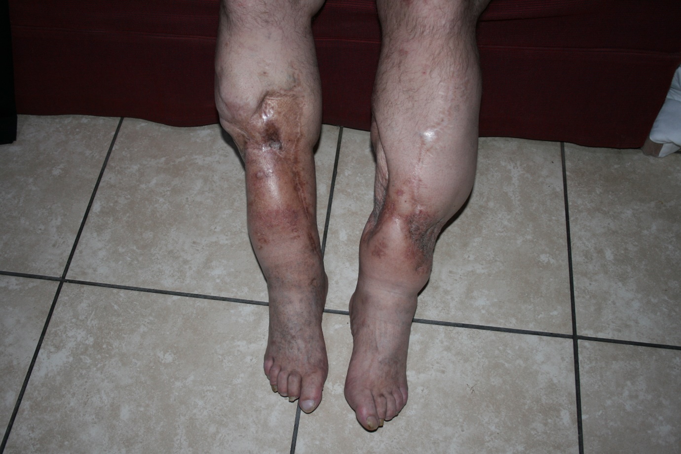 A close-up of a person's legs

AI-generated content may be incorrect.